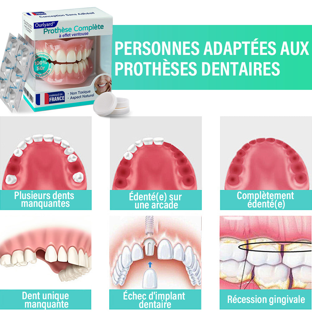 ✅ Fabriqué et expédié depuis la France | Prothèse complète à succion Ourlyard® 🍀up
